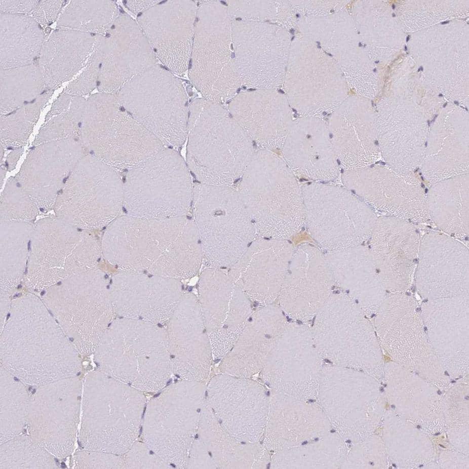 Immunohistochemistry SLC38A9 Antibody - BSA Free