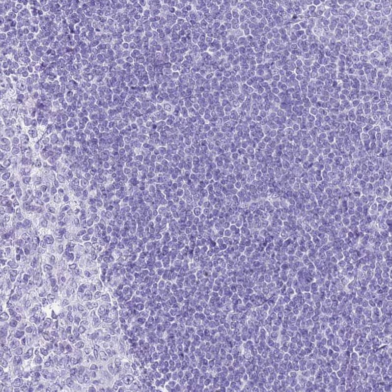 Immunohistochemistry SLC7A9 Antibody - BSA Free