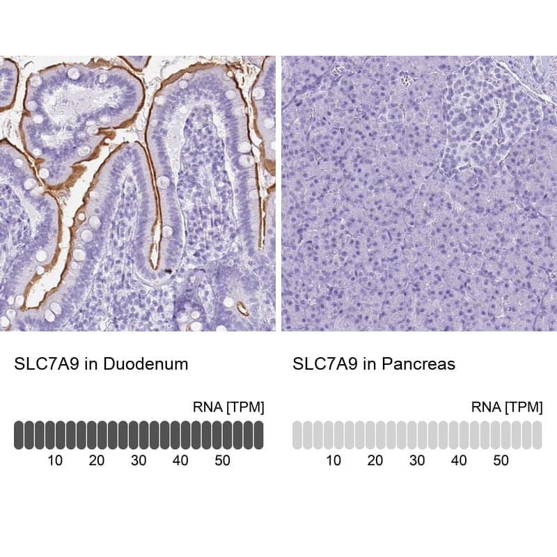 Immunohistochemistry SLC7A9 Antibody - BSA Free