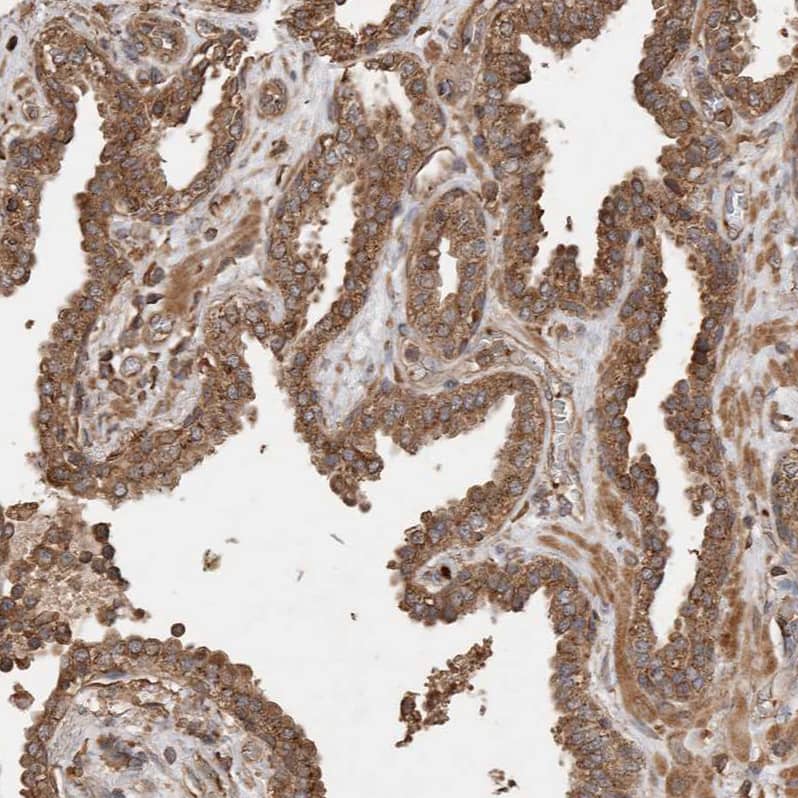Immunohistochemistry Sorting Nexin 31 Antibody - BSA Free