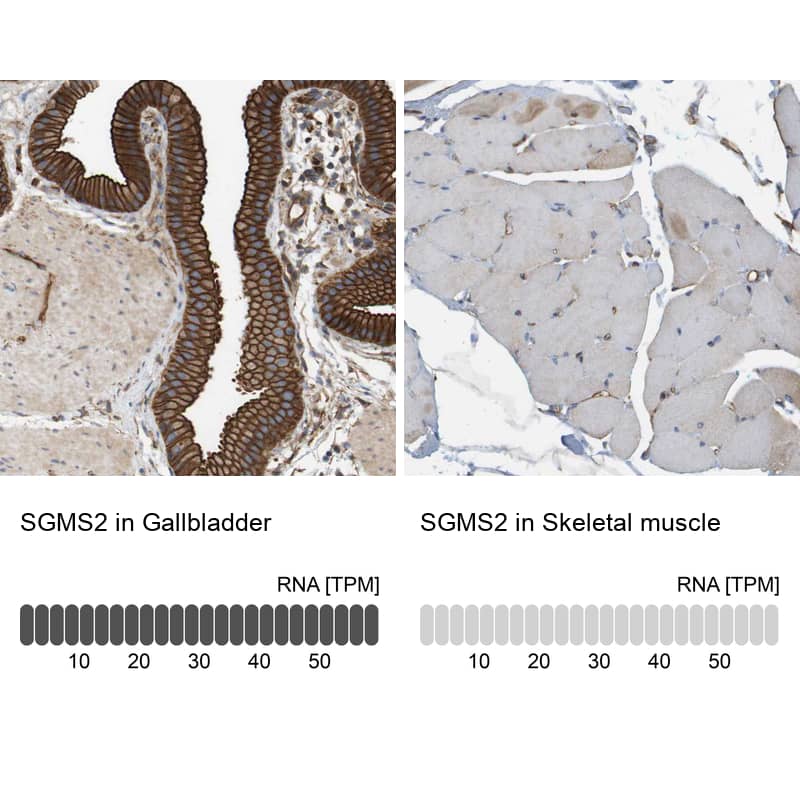 <b>Orthogonal Strategies Validation. </b>Analysis in human gallbladder and skeletal muscle tissues using NBP1-92436 antibody. Corresponding SGMS2 RNA-seq data are presented for the same tissues.