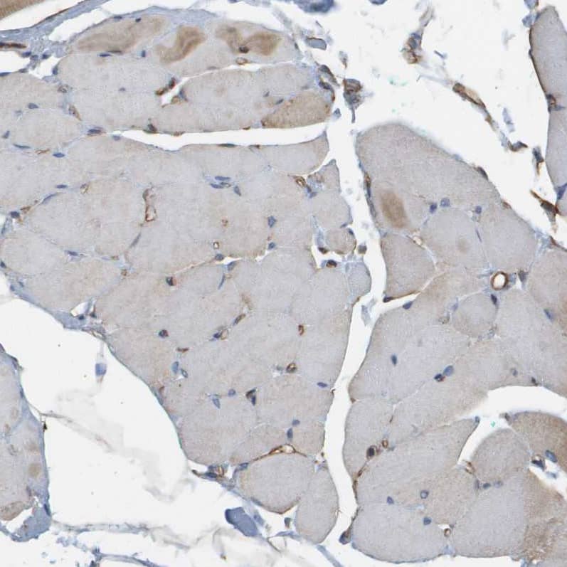 Staining of human skeletal muscle shows weak positivity in myocytes.