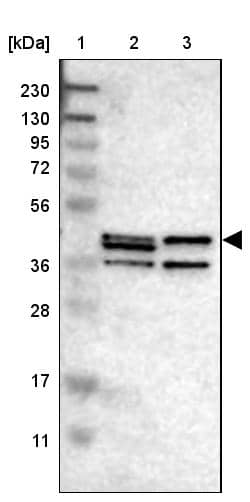 <b>Orthogonal Strategies Validation. </b>Lane 1: Marker [kDa] 230, 130, 95, 72, 56, 36, 28, 17, 11Lane 2: Human cell line RT-4Lane 3: Human cell line U-251MG sp