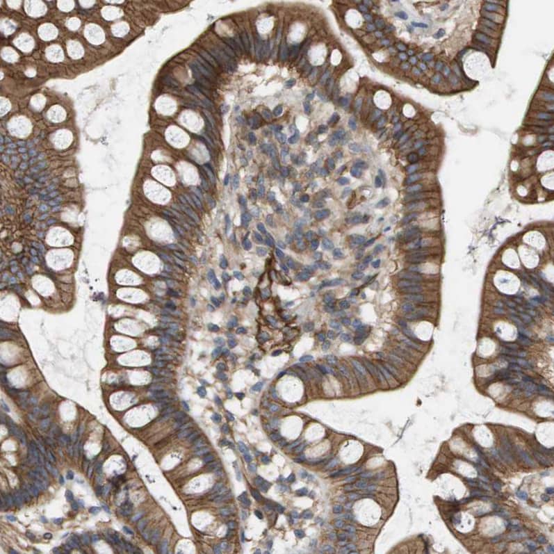 Staining of human small intestine shows moderate membranous positivity in glandular cells.