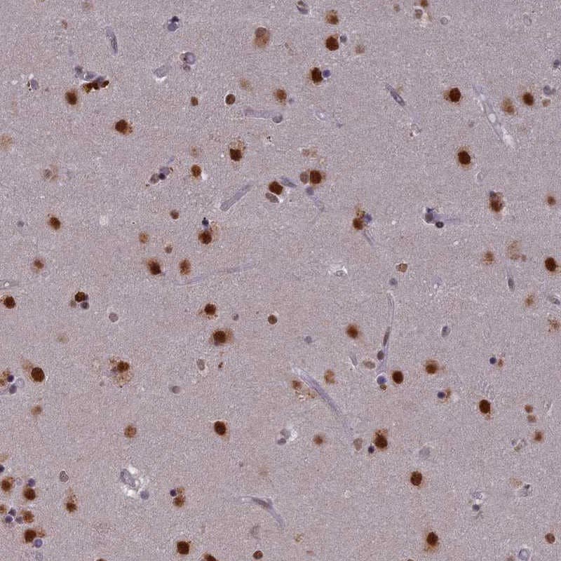 Staining of human caudate shows strong nuclear positivity in neuronal cells.