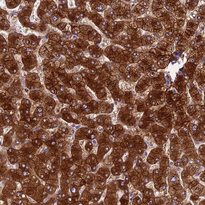 Staining of human liver shows strong granular cytoplasmic positivity in hepatocytes.