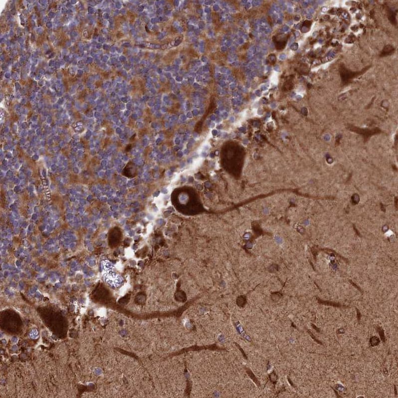 Staining of human cerebellum shows strong cytoplasmic positivity in purkinje cells.
