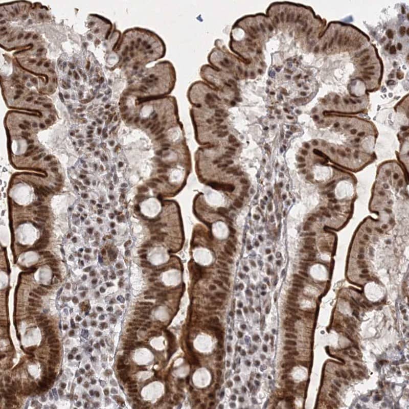 Staining of human duodenum shows strong nuclear and cytoplasmic positivity in glandular cells.