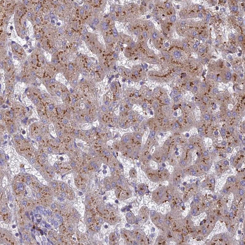 Staining of human liver shows moderate to strong granular cytoplasmic positivity in hepatocytes.