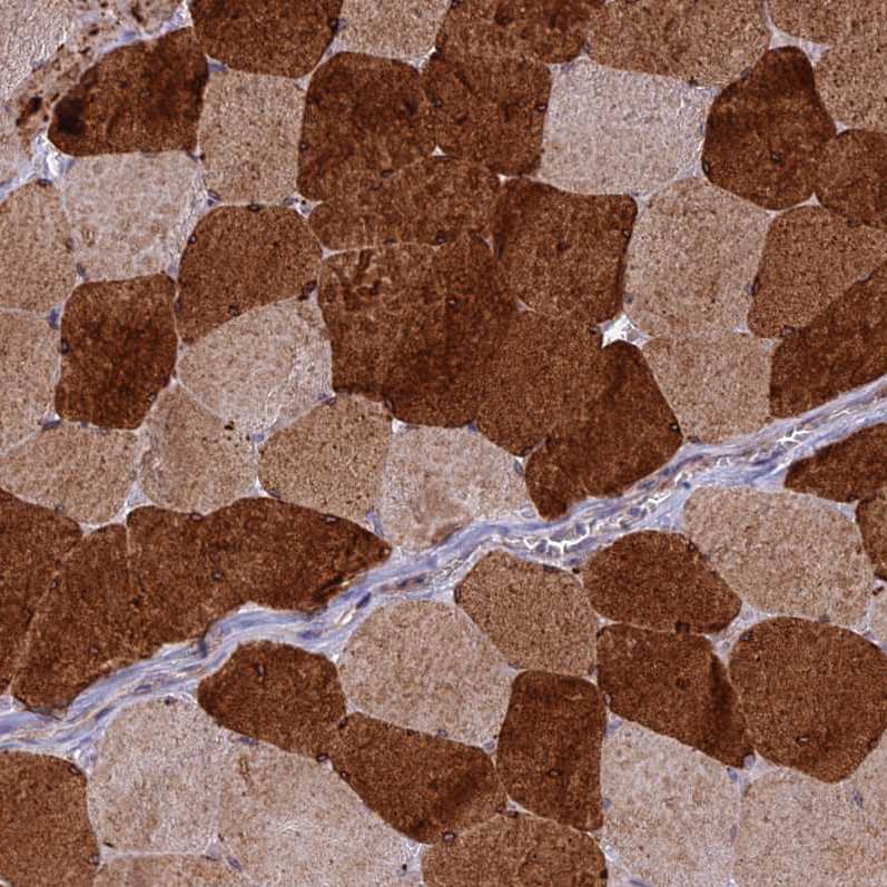 Staining of human skeletal muscle shows moderate to strong cytoplasmic positivity in myocytes.