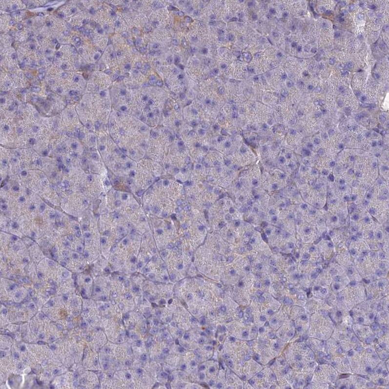 Staining of human pancreas shows low positivity in exocrine glandular cells as expected.
