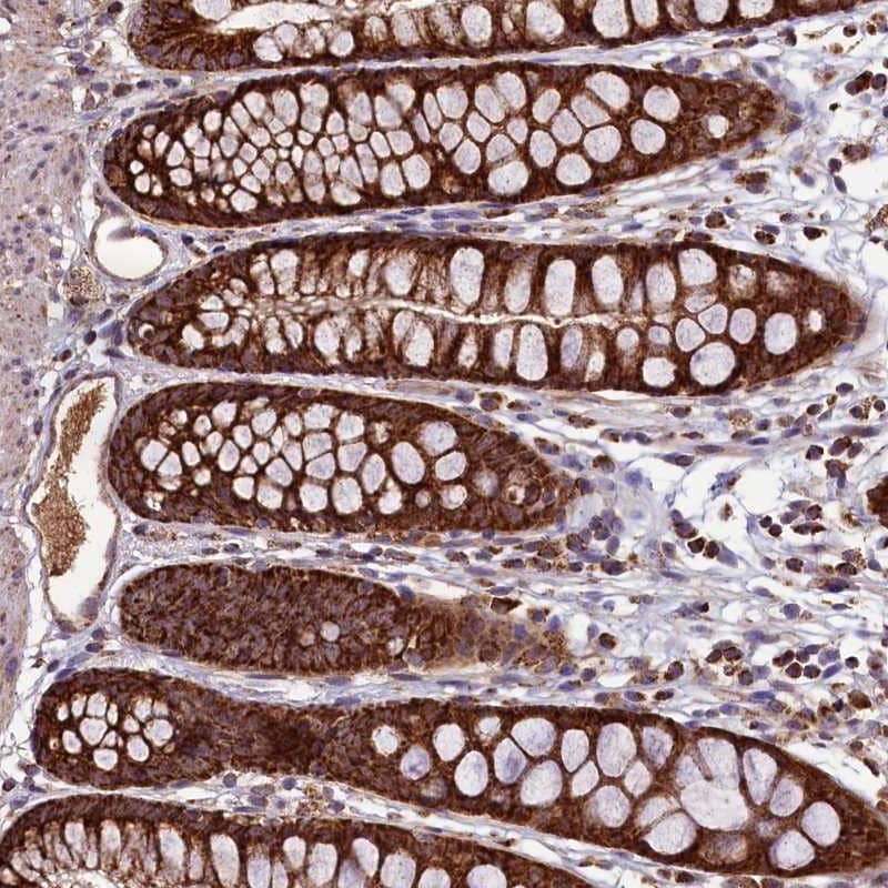 Staining of human rectum shows strong cytoplasmic positivity in glandular cells.