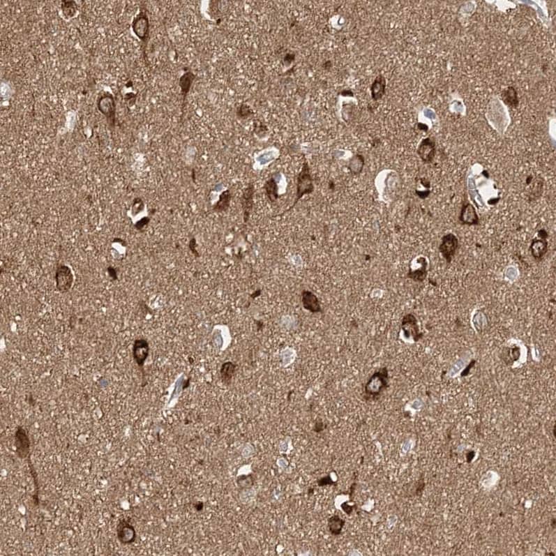 Staining of human cerebral cortex shows strong cytoplasmic positivity in neurons.