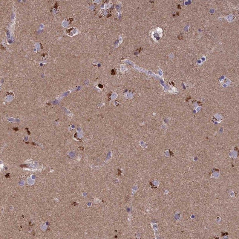 Immunohistochemistry-Paraffin STYX Antibody - BSA Free