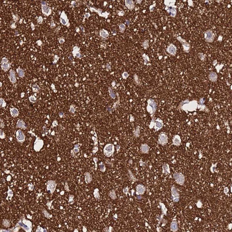 Immunohistochemistry SV2B Antibody - BSA Free