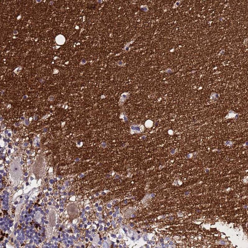Immunohistochemistry SV2B Antibody - BSA Free