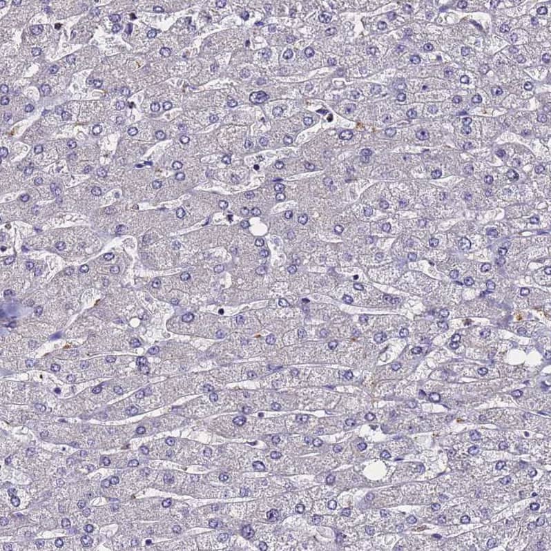Staining of human liver shows no positivity in hepatocytes as expected.