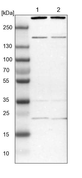 Lane 1: NIH-3T3 cell lysate (Mouse embryonic fibroblast cells)Lane 2: NBT-II cell lysate (Rat Wistar bladder tumour cells)