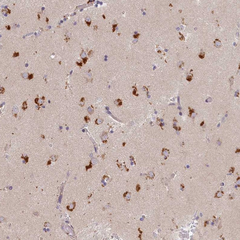 Staining of human caudate shows strong cytoplasmic positivity in neuronal cells.