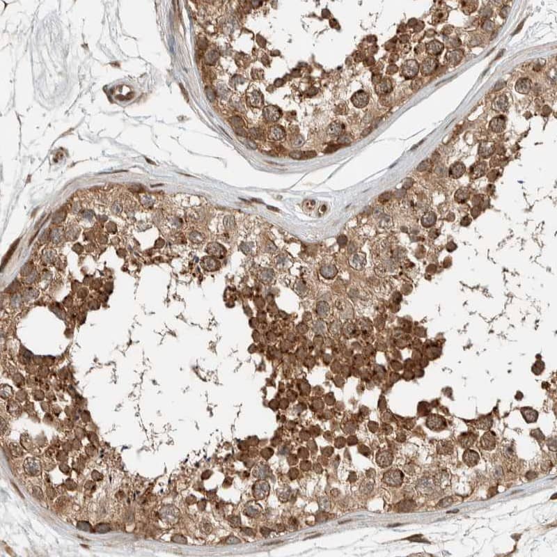 Staining of human testis shows strong cytoplasmic positivity in cells in seminiferous ducts.