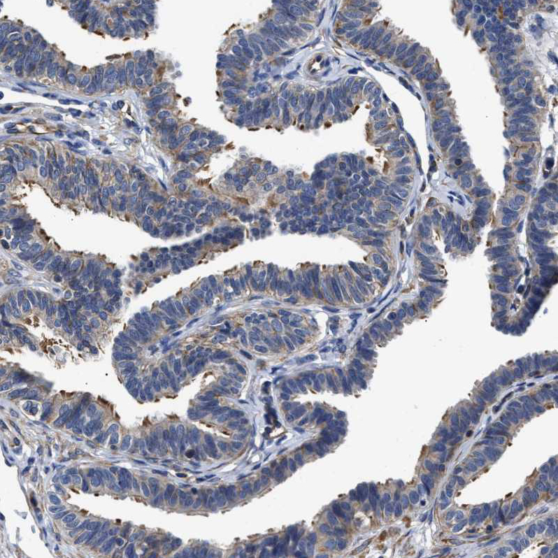 Staining of human fallopian tube shows very weak cytoplasmic positivity in glandular cells and ciliated cells.