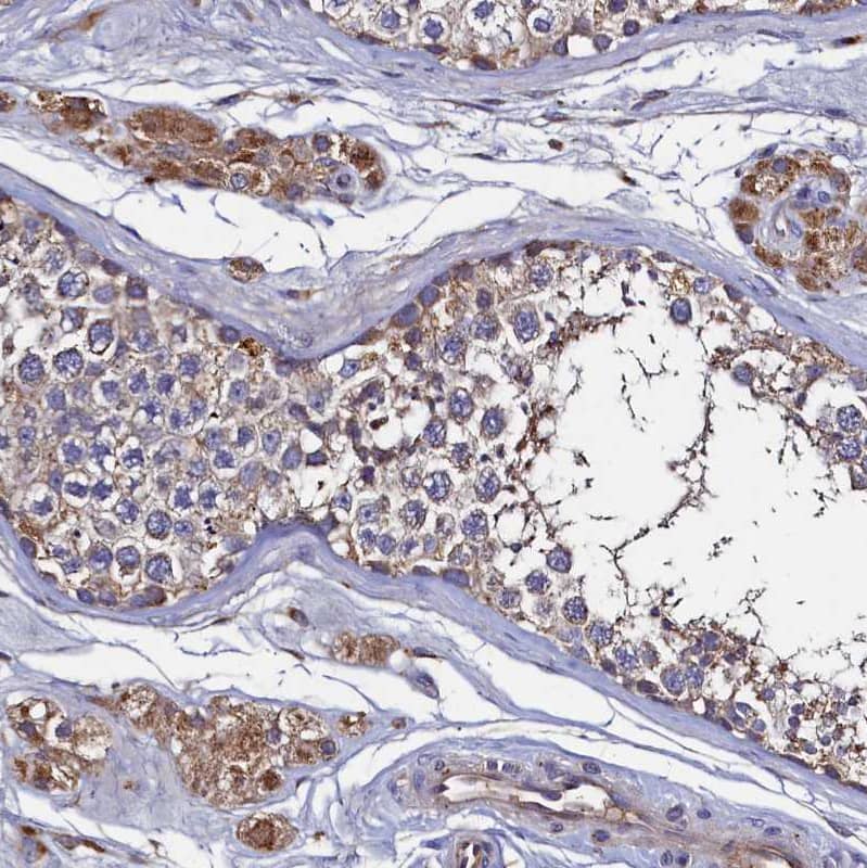 Immunohistochemistry-Paraffin Thymidine Kinase 2 Antibody - BSA Free