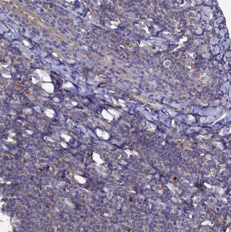 Immunohistochemistry-Paraffin Thymidine Kinase 2 Antibody - BSA Free