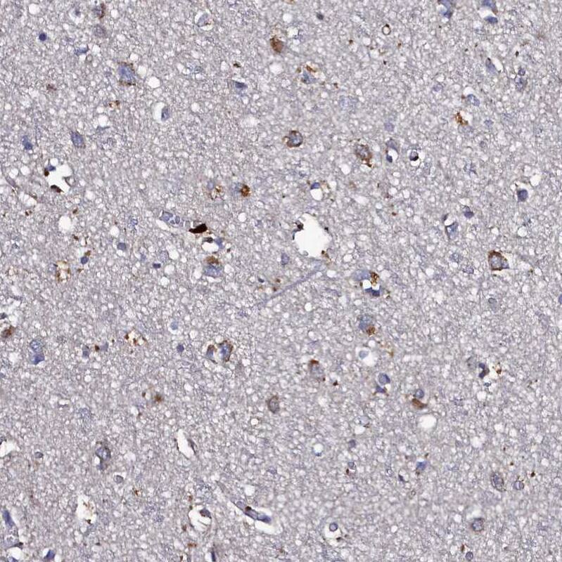 Staining of human Cerebral cortex shows moderate granular cytoplasmic positivity in neuronal cells.