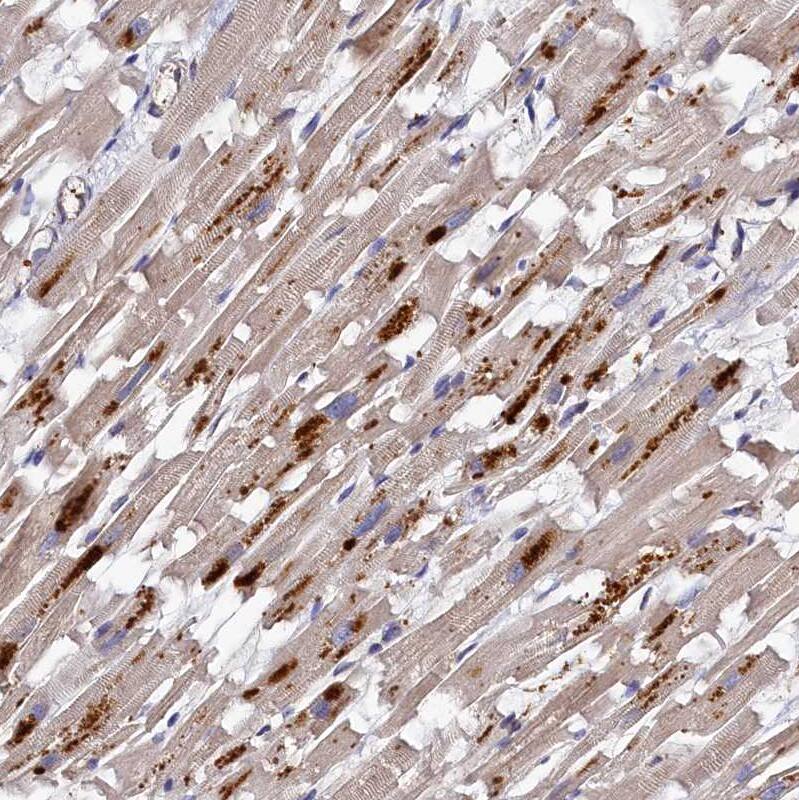 Staining of human heart muscle shows moderate granular cytoplasmic positivity in cardiomyocytes.