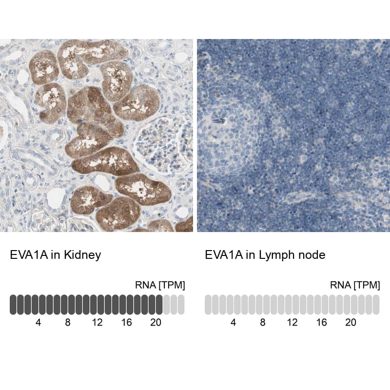 Immunohistochemistry TMEM166 Antibody - BSA Free