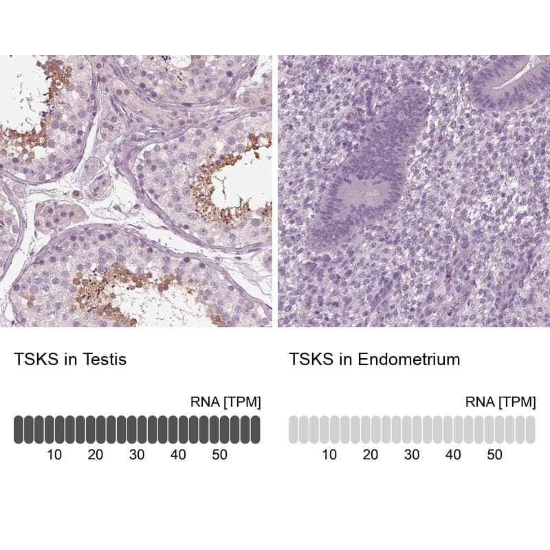 <b>Orthogonal Strategies Validation. </b>Analysis in human testis and endometrium tissues using Anti-TSKS antibody. Corresponding TSKS RNA-seq data are presented for the same tissues.