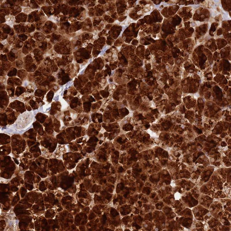 Staining of human pancreas shows strong cytoplasmic positivity in exocrine glandular cells.