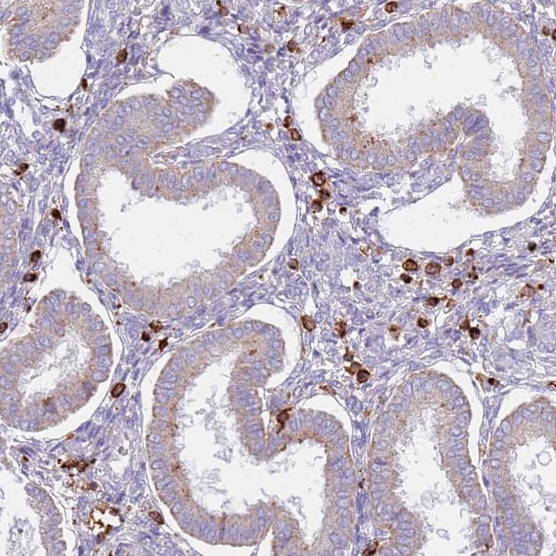 Staining of human endometrium shows strong cytoplasmic positivity in stromal cells.
