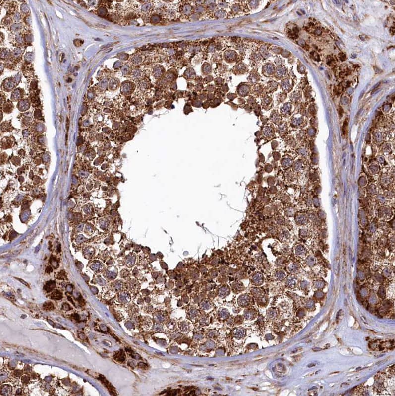 Staining of human testis shows strong positivity in cytoplasm in cells in seminiferous ducts.