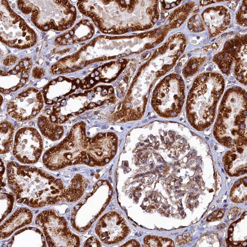Staining of human kidney shows strong positivity in cytoplasm in cells in tubules.