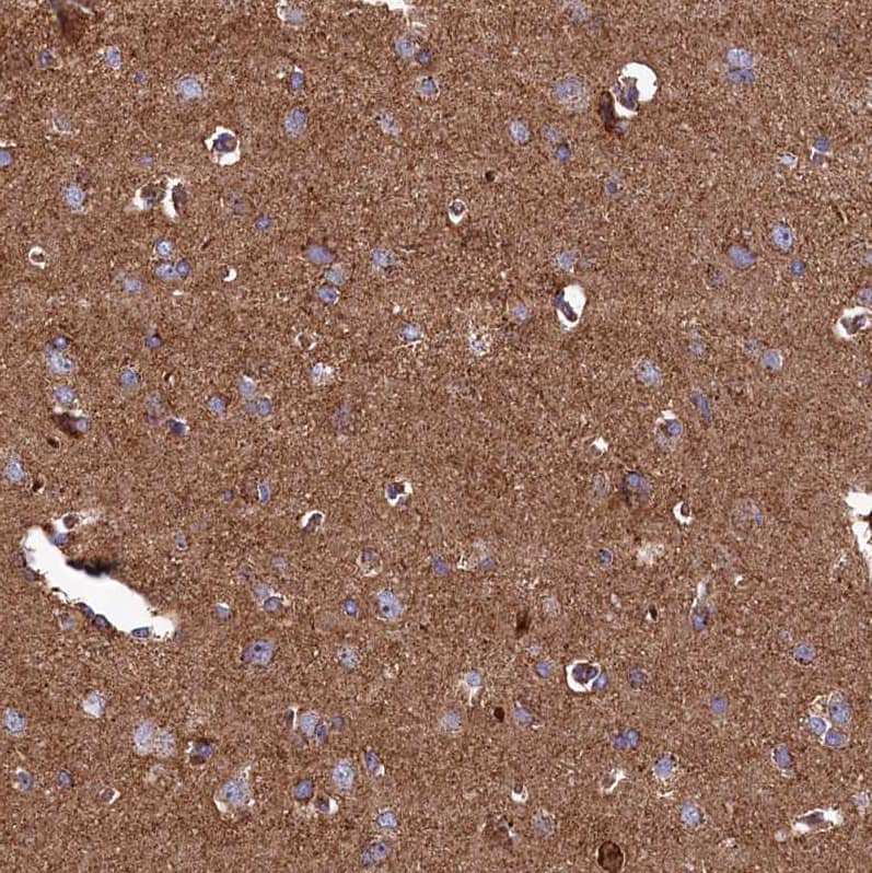 Staining of human cerebral cortex shows strong positivity in neuropil.