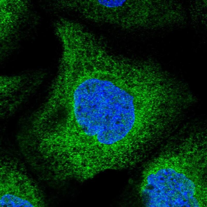 Staining of human cell line A-431 shows localization to endoplasmic reticulum.