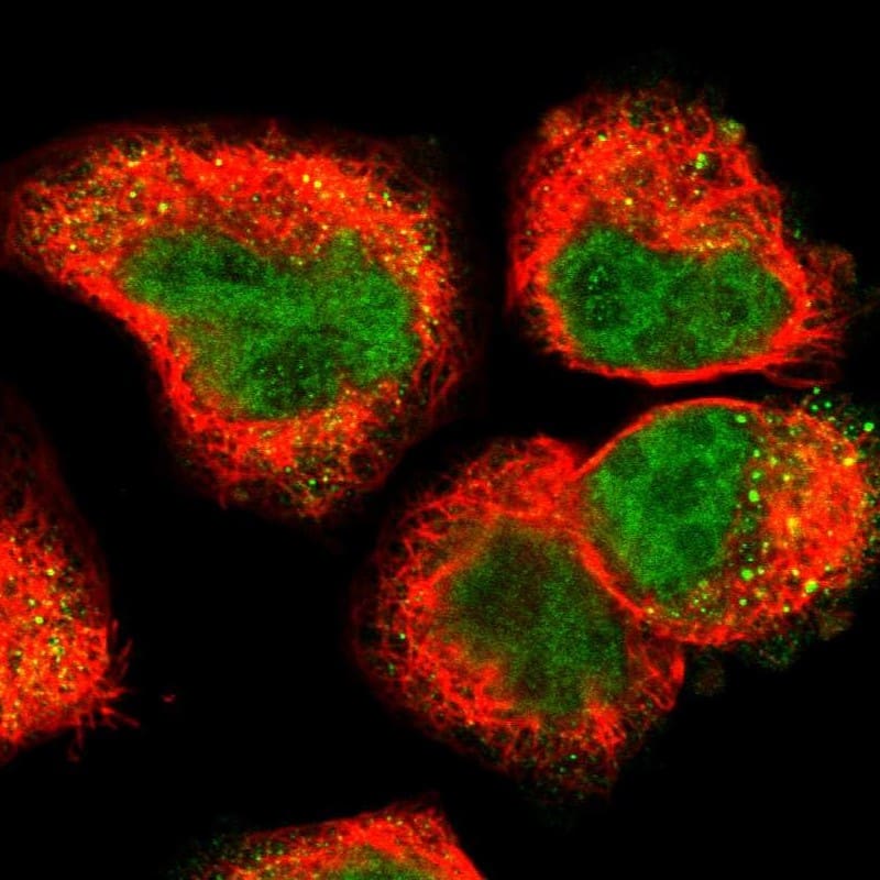 Staining of human cell line A-431 shows localization to nucleus & vesicles.