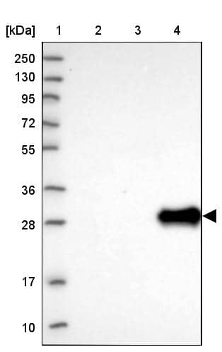 Lane 1: Marker [kDa] 250, 130, 95, 72, 55, 36, 28, 17, 10Lane 2: Human cell line RT-4Lane 3: Human cell line U-251MG spLane 4: Human plasma (IgG/HSA depleted)