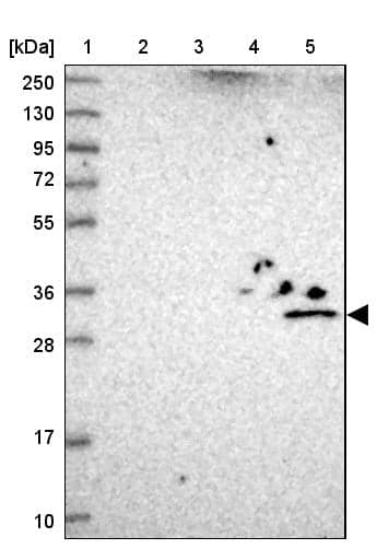 Western Blot UTP23 Antibody - BSA Free