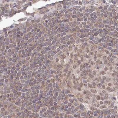 Staining of human lymph node using Anti-WAPL antibody NBP1-92578.