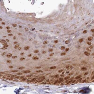 Immunohistochemistry-Paraffin WAPL Antibody - BSA Free