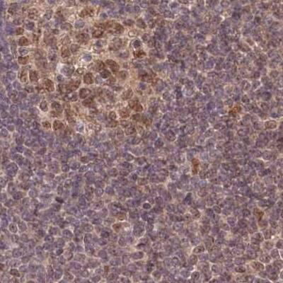 Immunohistochemistry-Paraffin WAPL Antibody - BSA Free