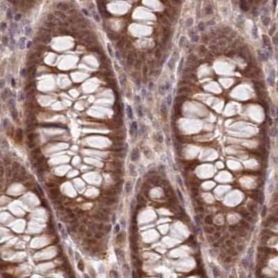 Immunohistochemistry-Paraffin WAPL Antibody - BSA Free
