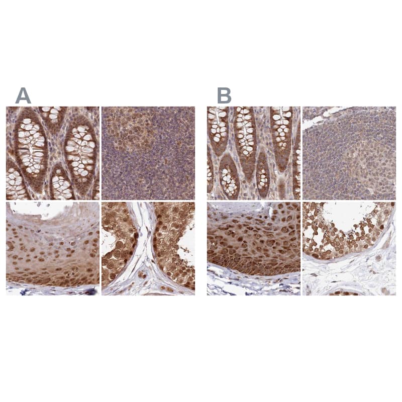 Immunohistochemistry-Paraffin WAPL Antibody - BSA Free