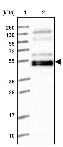 Lane 1: Marker [kDa] 250, 130, 95, 72, 55, 36, 28, 17, 10Lane 2: Human cell line RT-4