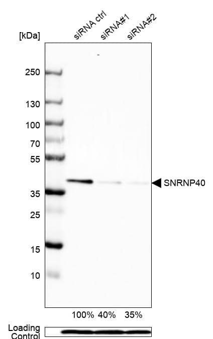 Analysis in Rh30 cells transfected with control siRNA, target specific siRNA probe #1 and #2. Remaining relative intensity is presented. Loading control: Anti-PPIB.