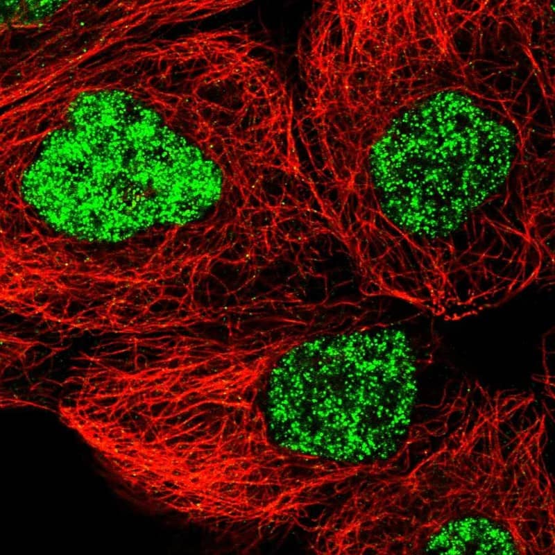 Staining of human cell line A-431 shows localization to nuclear speckles.
