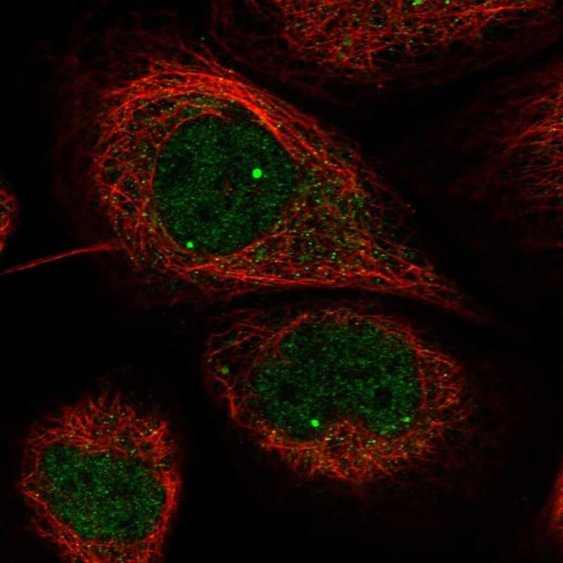 Immunocytochemistry/ Immunofluorescence WDR79 Antibody - BSA Free