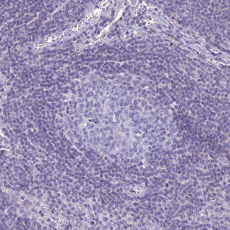 Staining of human lymph node shows no positivity in germinal center cells as expected.